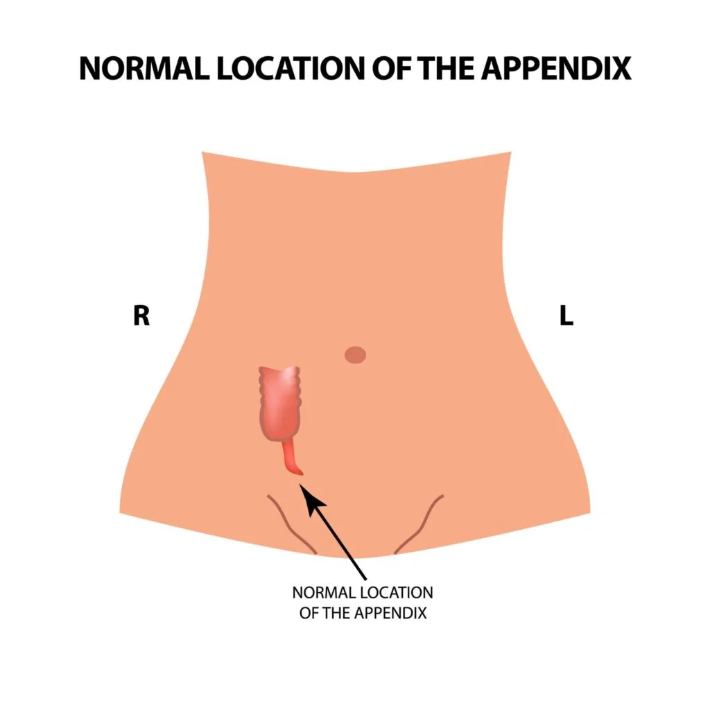 The Appendix Wasn't Useless After All — Here's Why It Exists