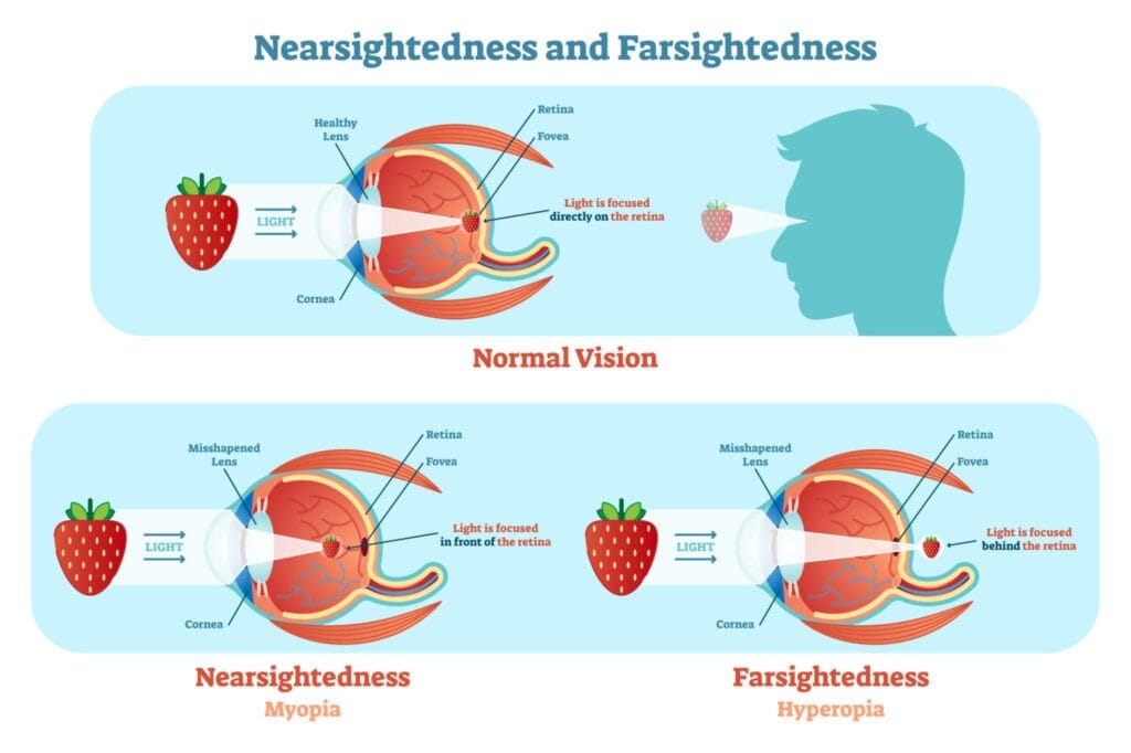 Infographic explaining why people have weaker vision showing nearsightedness, farsightedness, and human eye anatomy.