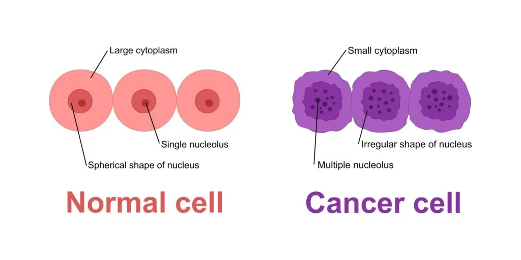 normal cell nucleus vs abnormal cell nucleus