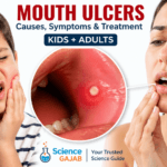 Realistic illustration of a painful mouth ulcer inside cheek with white center and red border, showing a child and an adult holding their cheeks in discomfort, healthcare concept with ScienceGajab branding.