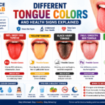 Different tongue colors and health signs explained with medical illustrations