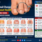 infographic titled 'What Toenail Changes Reveal About Health: 12 Warning Signs You Should Never Ignore.' The image shows a close-up of toenails under a magnifying glass, surrounded by illustrations of 12 common toenail abnormalities, including thickened nails, yellow discoloration, brittle nails, spoon-shaped nails, white spots, dark lines, nail lifting, pale nails, clubbing, redness around nails, ridges, and slow nail growth. The infographic explains how toenail changes can signal infections, nutritional deficiencies, circulation problems, diabetes, anemia, thyroid disorders, or other health conditions. It also includes doctor warning signs, toenail care tips,