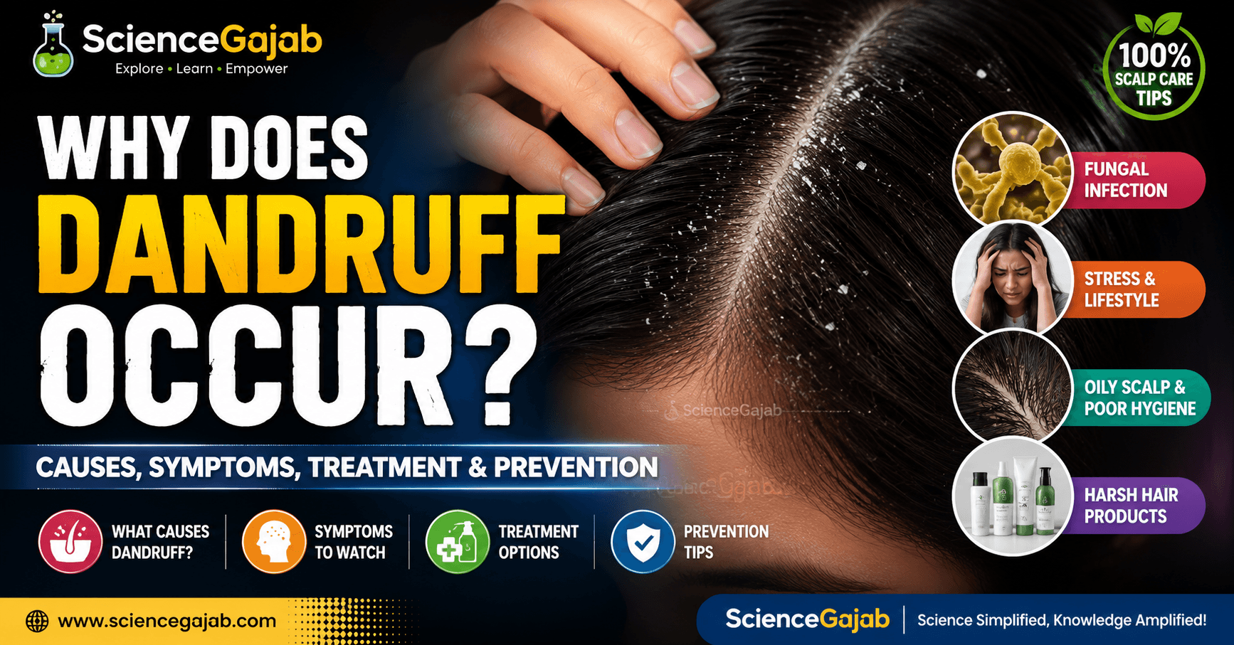 Close-up medical illustration of a human scalp with visible white dandruff flakes on dark hair, highlighting scalp irritation. The featured image includes the title "Why Does Dandruff Occur?" along with causes, symptoms, treatment, and prevention tips, branded with the ScienceGajab logo for educational health content.